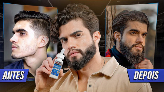 5 hábitos que vão fazer sua BARBA CRESCER com MINOXIDIL KIRKLAND 🧔🏻 - BARBA LENHADOR