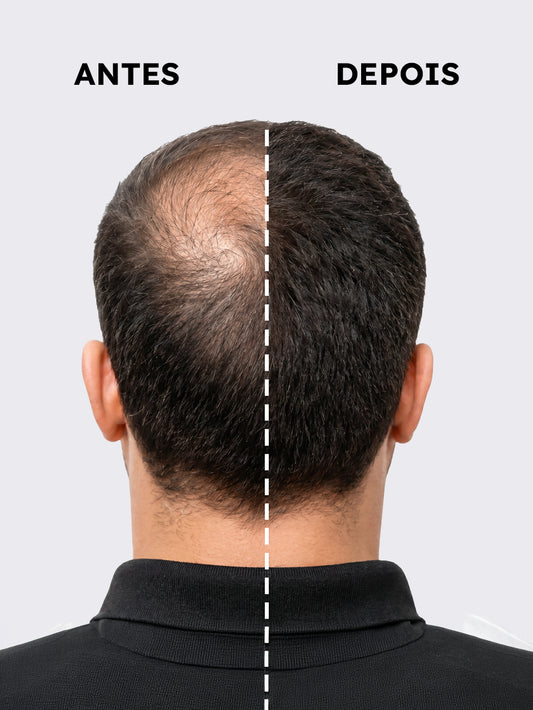 Multivitamínico Ativador MAJOR – Crescimento de Barba e Cabelo