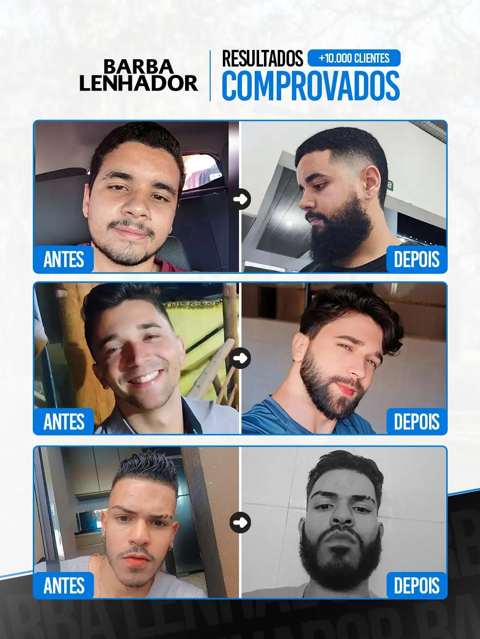 Minoxidil 5% com Conta - Gotas | Crescimento de Barba e Cabelo - BARBA LENHADOR
